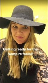 Getting Ready for the Vampire Facial - LaBelle Vie Medical Care and Aesthetics