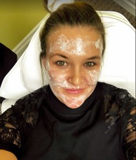 Starting the Vampire Facial - LaBelle Vie Medical Care and Aesthetics