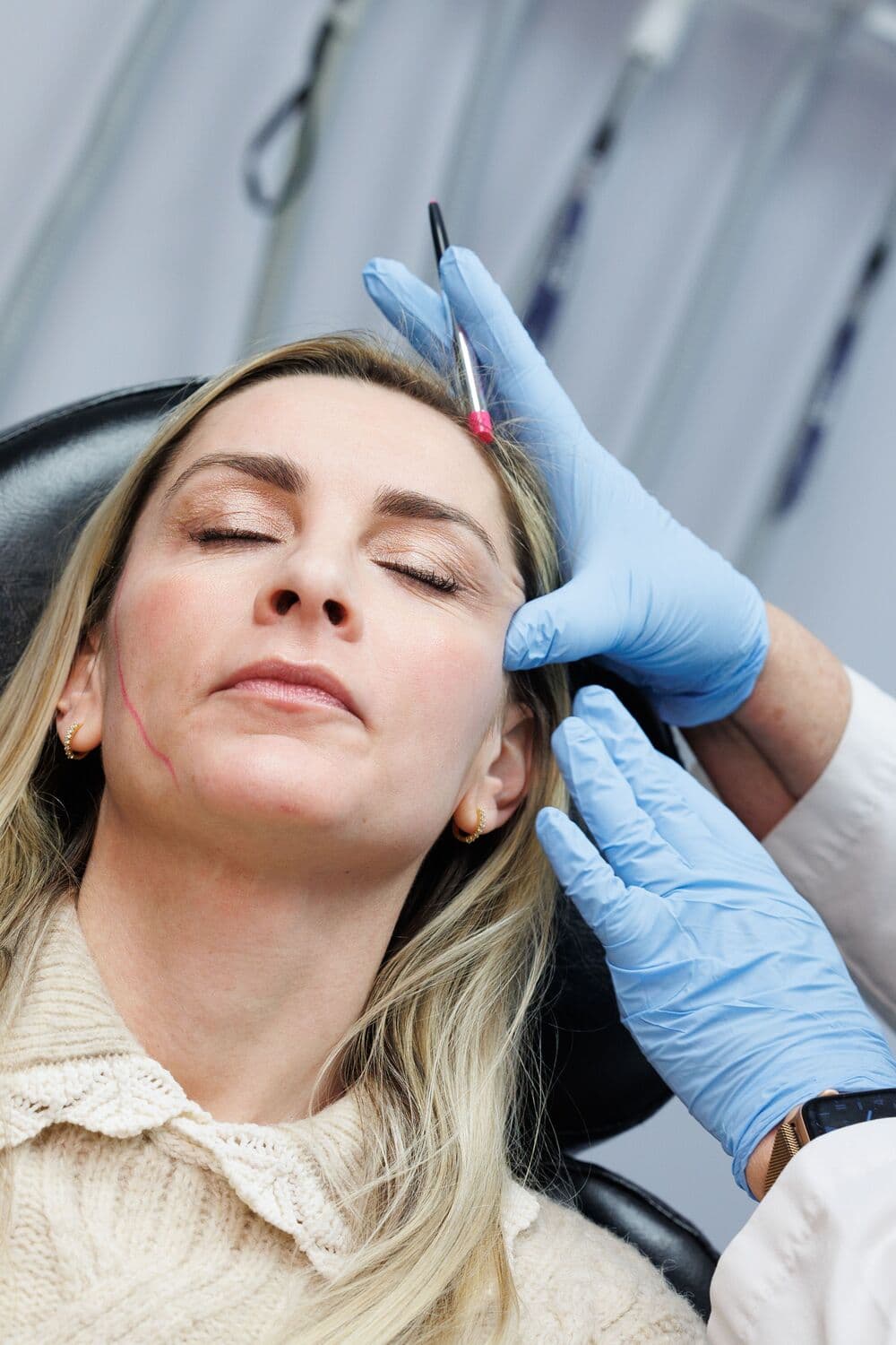 A blonde patient in a cream sweater reclining with her eyes closed while gloved hands mark her temple with a surgical pen, a guide line drawn along her cheek