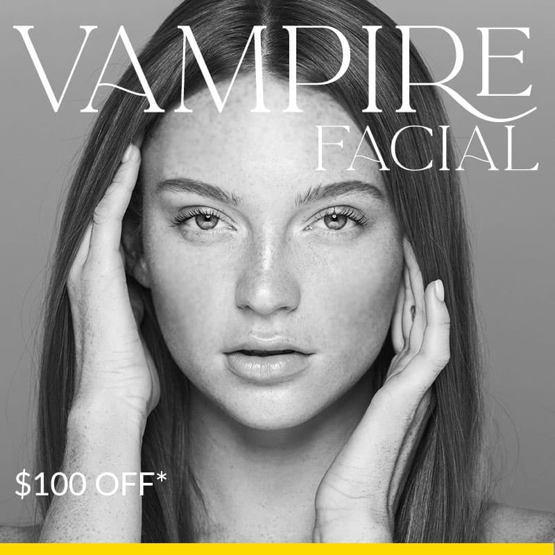 Vampire Facial: $100 off