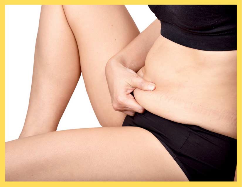 Who Is a Good Candidate for CoolSculpting?