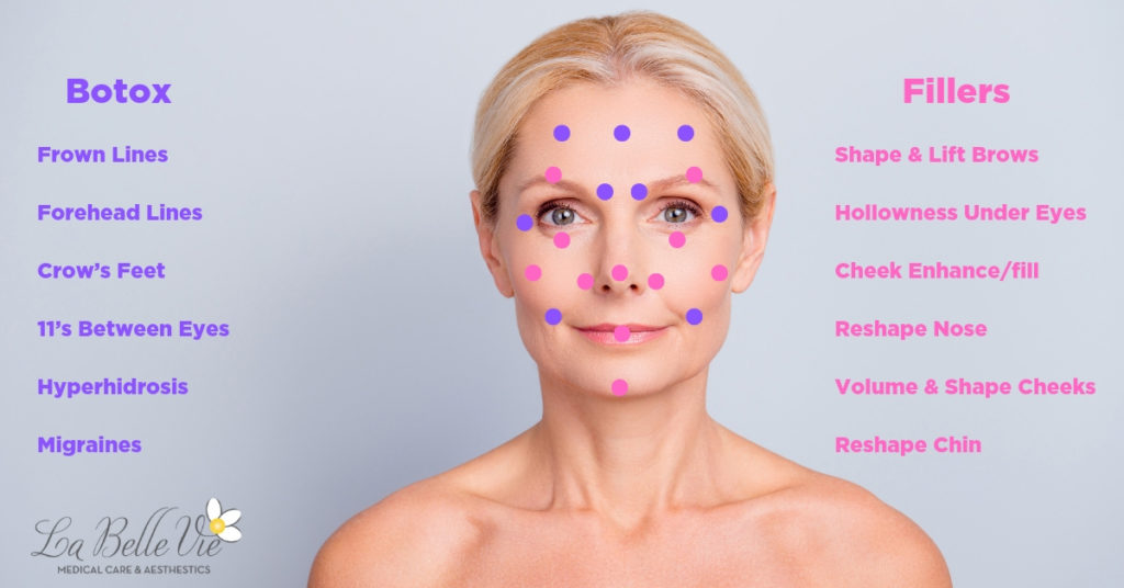Botox vs Dermal Face Fillers